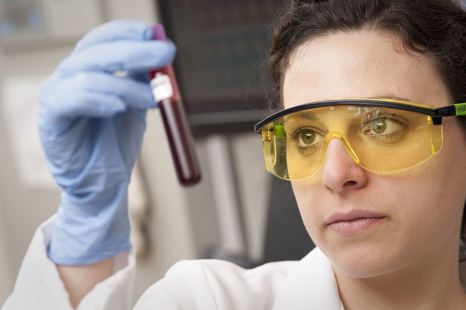 Una técnica de laboratorio examina un tubo de sangre